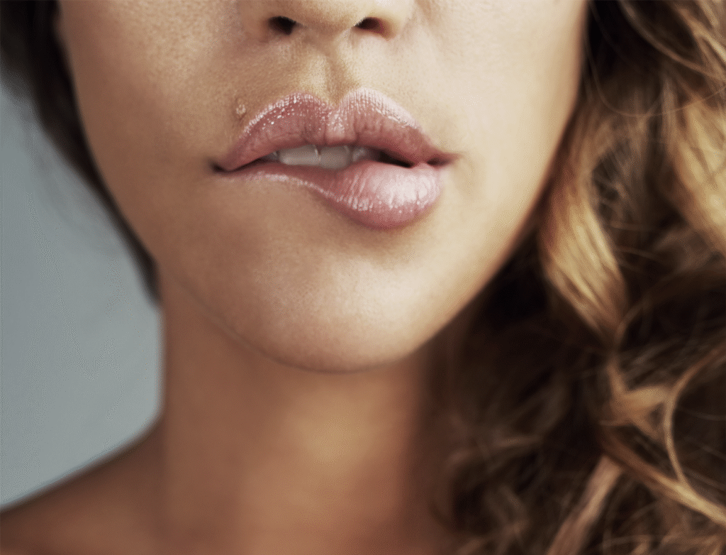 En jente som biter i leppen sin - fillersbehandling