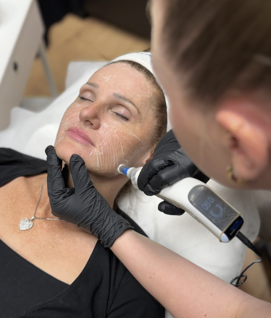 Behandler utfører dermapen 4 behandling på voksen dame i ansiktet